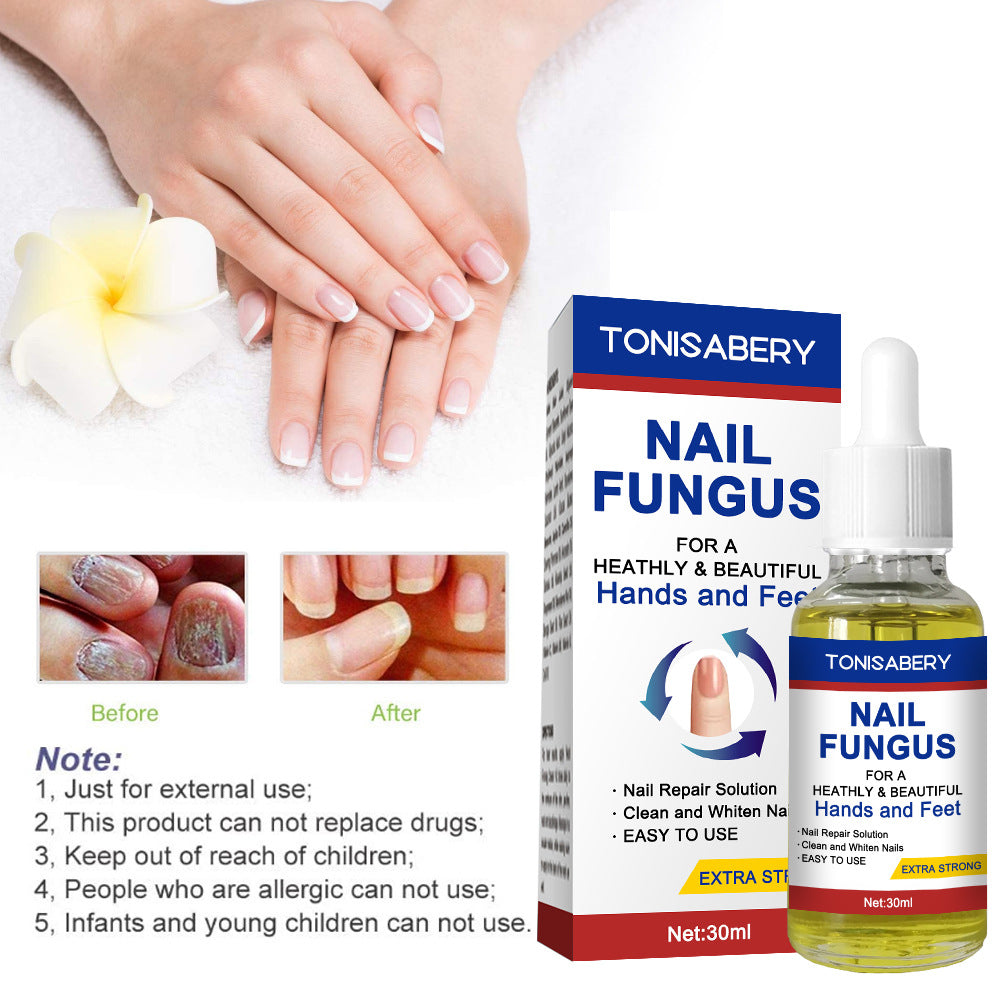 Nail Essence Treatment for Fungal Nails - 30 ml